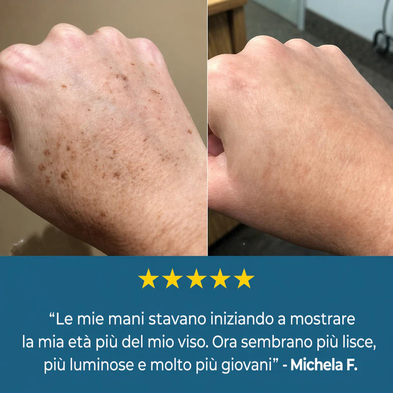 LushSecret™ Crema per macchie dell'età | Riduci le macchie scure del 93% in 7 giorni