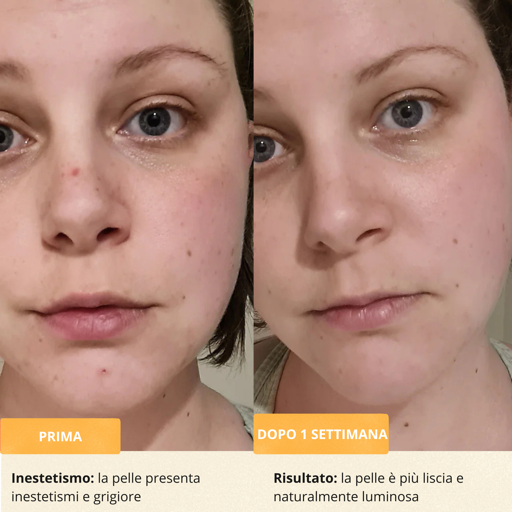 Turmeric Bubble Deep Mask™