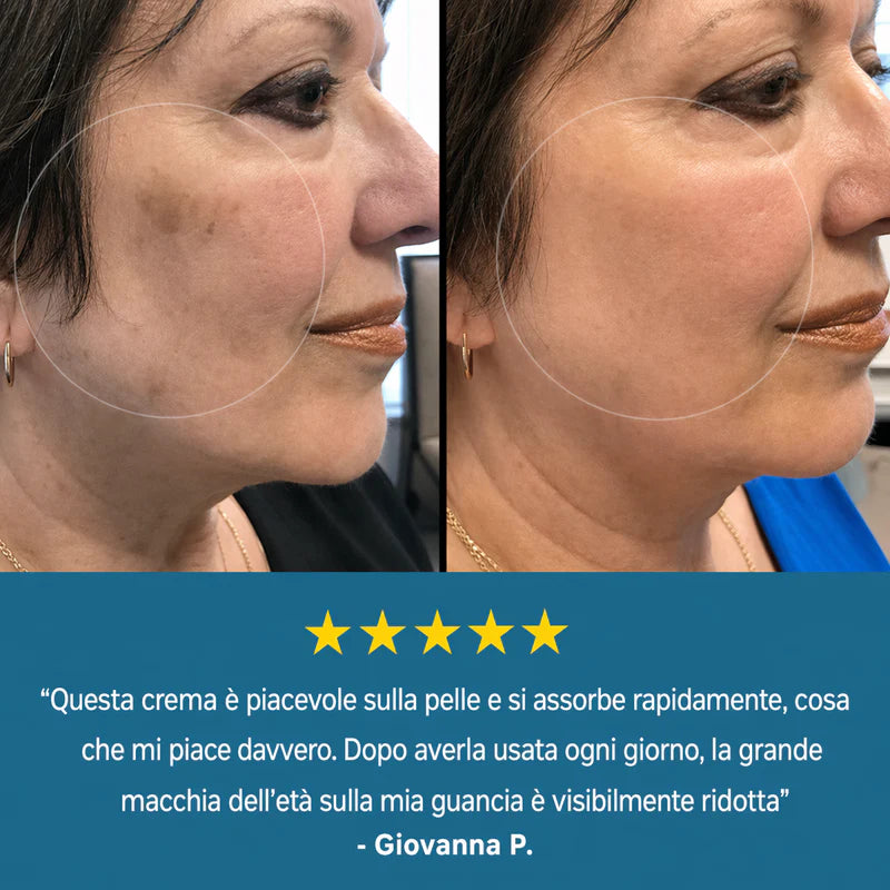LushSecret™ Crema per macchie dell'età | Riduci le macchie scure del 93% in 7 giorni